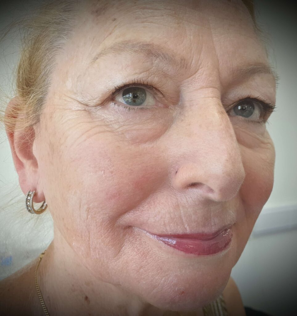 Lip Blush treatment results