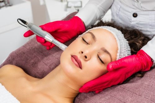Beautiful woman receiving microneedling rejuvenation treatment. Collagen Induction therapy.