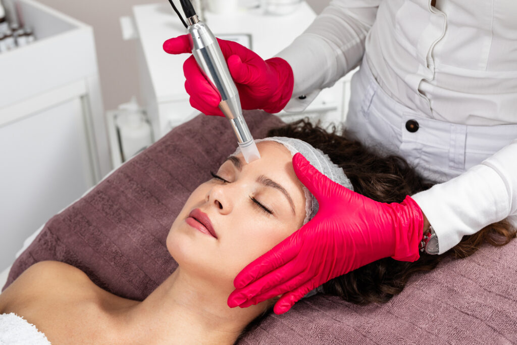 woman receiving microneedling rejuvenation treatment